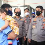 Bakti Kesehatan, Polda Sulsel Gelar Operasi Bibir Sumbing