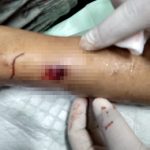 Polisi Selidiki Kasus Penembakan Di Tamansari Jakarta Barat